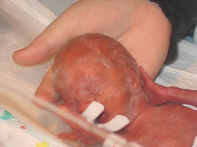 Jennifer laying her head in her moms hand