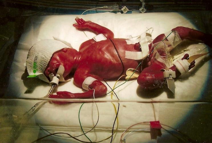 Jennifer right after she was born. 