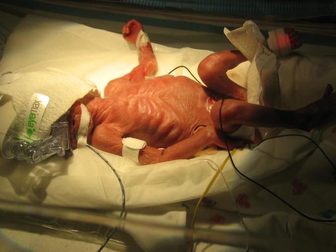 jennifer in nicu